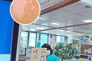 中药熏蒸的十大好处图片